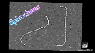 Spirochetes explained in tamil Handwritten notes in Englishmedical microbiology bacteriology [upl. by Watanabe442]