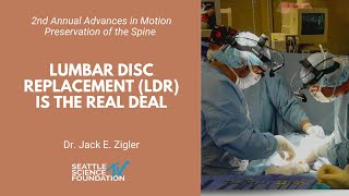 Lumbar Disc Replacement LDR Is the Real Deal  Jack E Zigler MD [upl. by Veator]