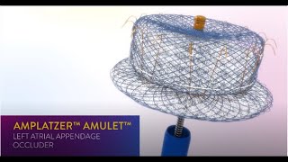 Guide to AFib and Stroke Risk Reduction – Amplatzer Amulet LAA Occluder [upl. by Swihart]