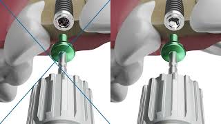 Implantation amp Primary Implant Sealing of NEVO ELEMENT amp CONTACT [upl. by Kiele]