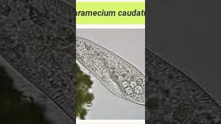 Paramecium part 11 bihar biology paramecium paramecium caudatum Bihar university zoology [upl. by Madonna]