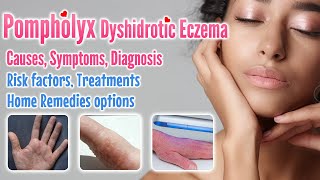 Pompholyx overview causes signs symptoms treatment option and home remedies  Dyshidrotic eczema [upl. by Grand24]