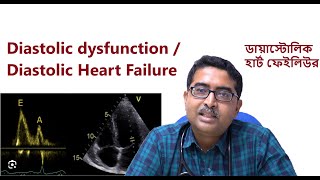 Diastolic dysfunction in Echocardiography  Diastolic Heart Failure ডায়াস্টোলিক হার্ট ফেইলিউর [upl. by Pattie565]