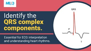 Identifying components of the QRS complex [upl. by Meece890]