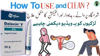 Dalacin v vaginal cream  how to use Clindamycin Phosphate vaginal cream [upl. by Ilona]