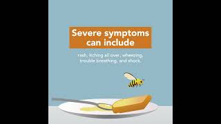 Bee Stings Symptoms amp Treatment  Merck Manual Consumer Version [upl. by Ivers]