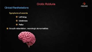 Orotic aciduria  Usmle biochemistry case based discussion [upl. by Paderna]