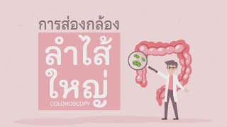 การเตรียมตัวสำหรับ “การส่องกล้องลำไส้ใหญ่” Colonoscopy [upl. by Lippold]