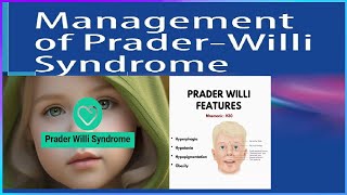 🔴What Is PraderWilli Syndrome ❓He also may have these symptoms👀👀 [upl. by Yleak]