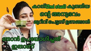 Ear piercingBest remedy for ear piercing infection in malayalamear secound studnose piercing [upl. by Patti]