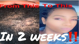 2 Week Hair Growth Routine Hair Growth Tips I WAS BALD SIS‼️ [upl. by Chip]