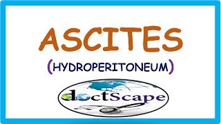 ASCITES  causespathophysiology dx and treatment by DoctScape [upl. by Gurias]