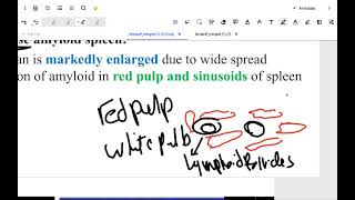 cell injury part2  Amyolid and hyaline degeneration [upl. by Kalila881]