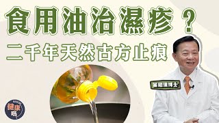 轉季濕疹患者必看！  改善濕疹 就靠一種食用油？｜中醫5大濕疹止痕法 重症濕疹患者當寶｜二千年前天然古方 嬰兒都用！｜健康嗎HealthCodeHK【問問崔博士】濕疹篇上集eczema [upl. by Hillie]