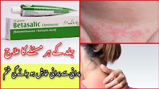 Betasalic ointment review  Betasalic cream ke fayde  How to use betasalic ointment  خارش کا علاج [upl. by Farman]