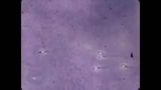 Fascinating lab footage of sperm [upl. by Keven93]