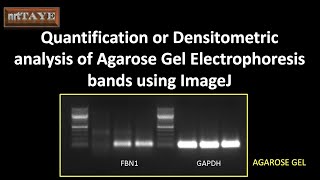 Quantification or densitometric analysis of agarose gel electrophoresis bands using ImageJ [upl. by Anyad]