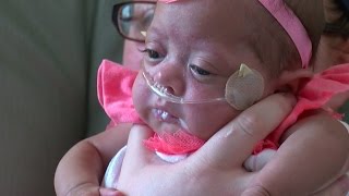 Baby Zara A MicroPreemie Finally Goes Home [upl. by Stiruc299]