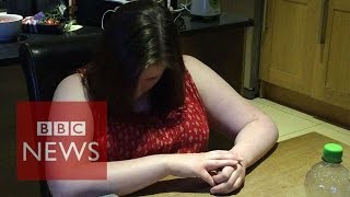 Narcolepsy What is it like to have a cataplexy attack  BBC News [upl. by Mian]