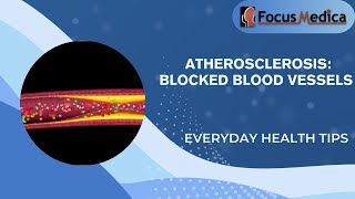 Atherosclerosis Blocked Blood Vessels [upl. by Rog]