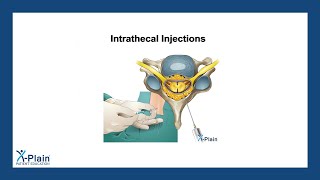 Intrathecal Injections [upl. by Eahsat]