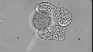 Entamoeba histolytica trophozoites [upl. by Cristie731]