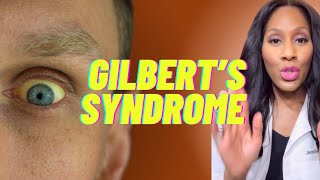 What is Gilbert’s Syndrome What Are the Symptoms of Gilbert’s Syndrome A Doctor Explains [upl. by Kikelia]