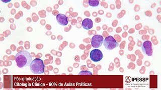 Pós Graduação em Citologia Clínica  60 de aulas práticas [upl. by Haleemaj507]