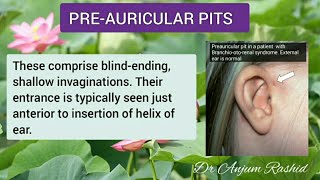 Preauricular Pit Causes  Five Possibilities To Consider  Preauricular Pits Reasons [upl. by Brunhilde]