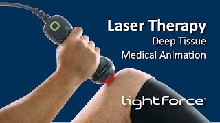 Laser Therapy  Deep Tissue Medical Animation [upl. by Airdnax]