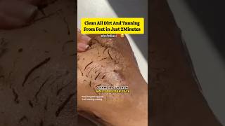 🔥Get Fair Feet in 5MinutesRemove Suntan Easily At HomeEasy pedicureskincare shorts viralvideo [upl. by Fritz]