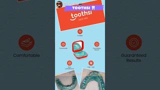 Dental Toothsi  Invisible Splint  Tooth Cap Close Method  Tamil Dental Lab  dentist viralvideo [upl. by Rocky]