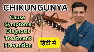 Chikungunya बुखार के लक्षण। Chinkungunya fever symptoms diagnosis treatment amp prevention [upl. by Cyndia176]