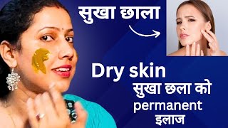 सुखा र खुस्क छाला dry skin काे लागी parmanent घरेलुु उपाए यो winter मा 👌 [upl. by Oratnek706]