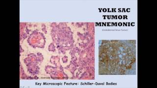 Yolk Sac Mnemonic [upl. by Nnoryt]