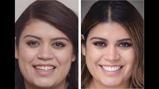 Cosmetic Dentistry from an Accredited Cosmetic Dentist [upl. by Llenrahc640]