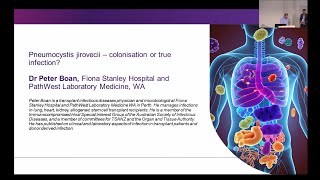 Pneumocystis jirovecii – colonisation or true infection Dr Peter Boan [upl. by Souvaine]