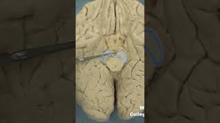 Interpeduncular fossa neuroanatomy brainstembrainWCUCOM Neuroscience [upl. by Christophe]