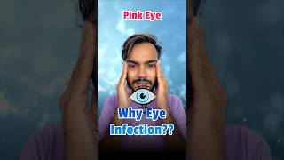 Eye Infection Conjunctivitis Pink Eye  Why is eye Infection Spreading in India fact short [upl. by Moncear]