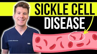 Doctor explains SICKLE CELL DISEASE  Causes symptoms and treatment [upl. by Hoi]