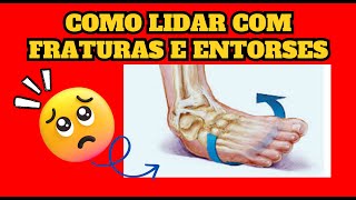 COMO LIDAR COM FRATURAS E ENTORSES [upl. by Tiloine]