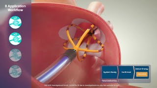 FARAPULSE™ Pulsed Field Ablation System Animation [upl. by Imuyam]