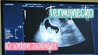 Vlog 70 10 weken zwanger 🤰🏼 termijnecho  Balanceyourhealthnl [upl. by Aggarwal]