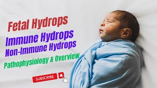 Fetal Hydrops Immune Hydrops NonImmune Hydrops Hydrops fetalis Robbins Pathology Chapter 7 [upl. by Obelia]