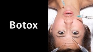 Botox Injections [upl. by Adnor]