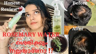 🥀💦 മുടി കൊഴിച്ചിൽ മാറും 🔥Result 💯‼️ Rosemary Water Alps GoodnessBEING US BY AJ [upl. by Eugenius]