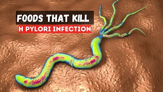 5 Foods That Kill H Pylori Infection [upl. by Sotos]