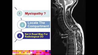 02 ERIC Spine Non Trauma  Emergency Imaging [upl. by Editha]