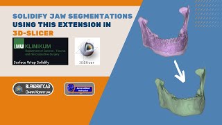 Solidify Jaw Segmentations in 3DSlicer using this extension [upl. by Aned]