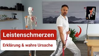 Leistenschmerzen einfach erklärt  Wie sie entstehen und was Du dagegen tun kannst ✅ [upl. by Niwrehs]